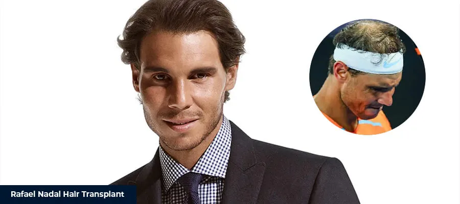 avant après rafael nadal