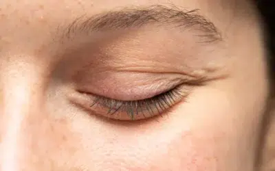 Comment se debarrasser cernes poches yeux Comment se débarrasser cernes poches yeux