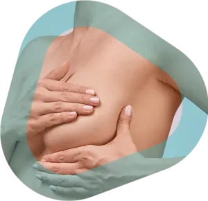 Mastopexie, éviter contours prothèses mammaires soient apparents