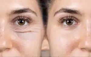 chirurgie esthétique Tunisie