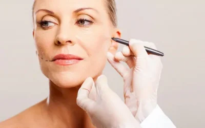 lifting cervico facial Lifting cervico-facial lifting-malaire