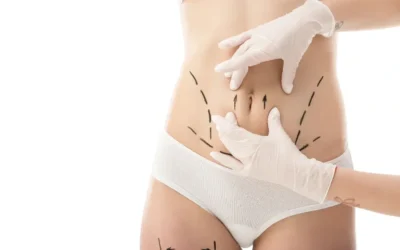 liposuccion 1 Liposuccion hanches fesses silhouette
