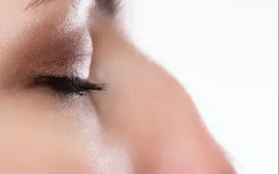 Rhinoplastie medicale Conserver l’apparence ethnique nez