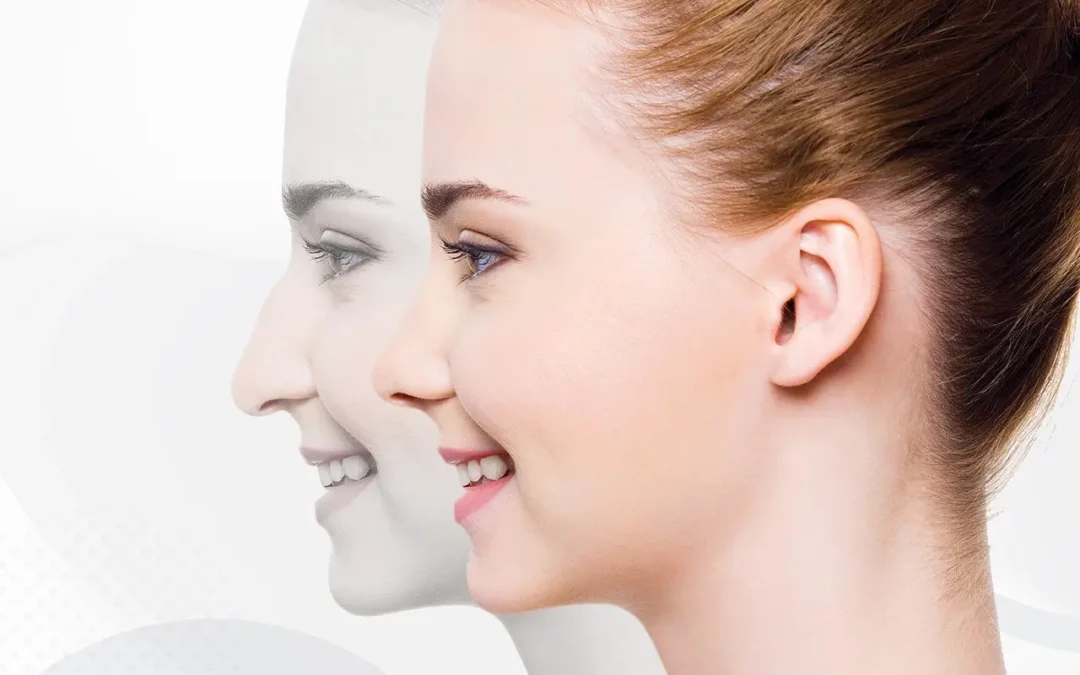 rhinoplastie de reduction qu’il faut savoir