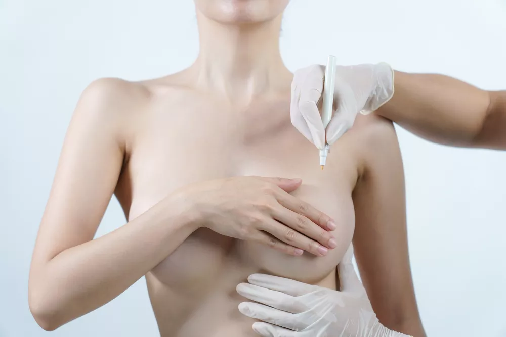La réduction mammaire pour qui pourquoi