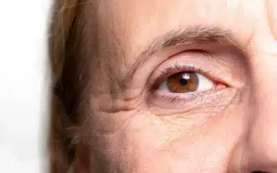 traiter le creusement du dessous des yeux tunisie Traiter le creusement du dessous des yeux