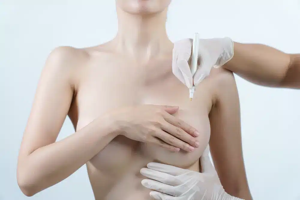 Réduction mammaire Tunisie