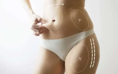 Chirurgie esthétique lyon
