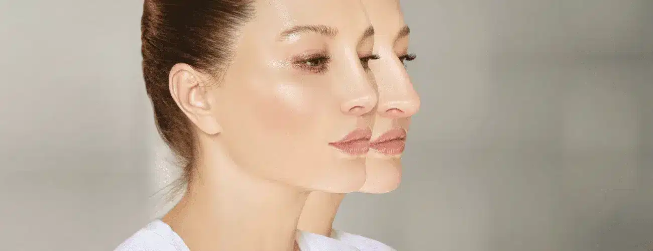 Chirurgie du nez la rhinoplastie