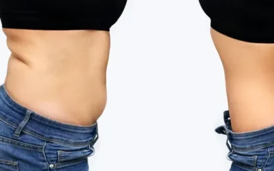 Chirurgie esthetique reparatrice du ventre Chirurgie esthétique réparatrice du ventre