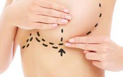Chirurgie mammaire tunisie estetikatour esthetique Malformations mammaires quel traitement