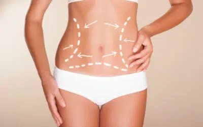 Liposuccion un remede miracle pour maigrir width1024 A propos de liposuccion