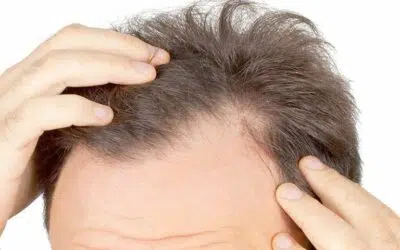 cheveux greffe tunisie estetika tour Greffe cheveux tunisie