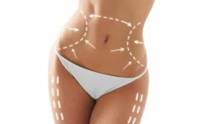 chirurgie esthetique silouhette corps estetika tour tunisie Les opérations les plus courantes en Tunisie