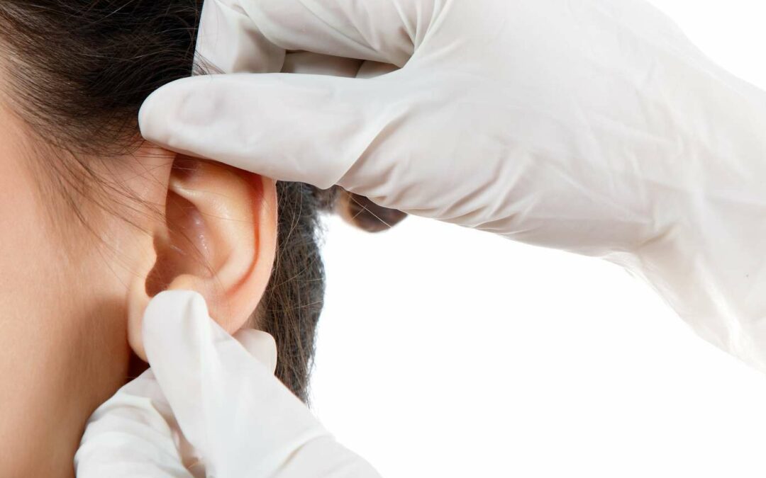 CHIRURGIE DES OREILLES DÉCOLLÉES: OTOPLASTIE, corriger difformités oreilles