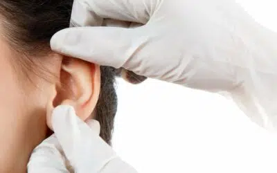 otoplastie tunisie estetikatour chirurgie des oreilles prix Corriger difformités oreilles