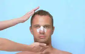 Rhinoplastie homme