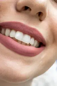 Prix rhinoplastie