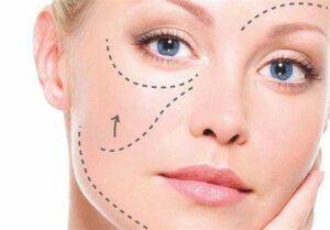 chirurgie esthetique tunisie tarif