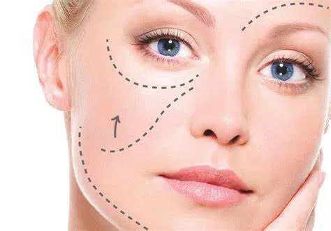 Chirurgie Esthetique Tunisie tarif