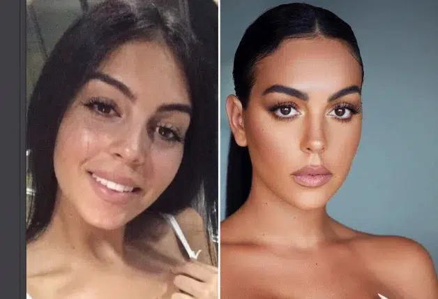 Georgina Rodriguez et la Chirurgie Esthétique