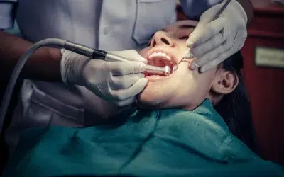 Implants dentaires Tunisie en 2023