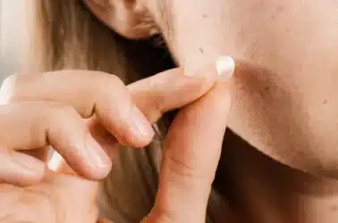 Les patchs anti-imperfections