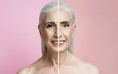 before after portrait mature woman retouched Solutions aux imperfections visage liées vieillissement