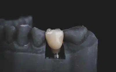 implants dentaire tunisie Implant dentaire douleur