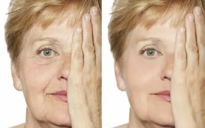 Chirurgie esthetique pour un resultat Naturel Chirurgie esthétique pour un résultat Naturel