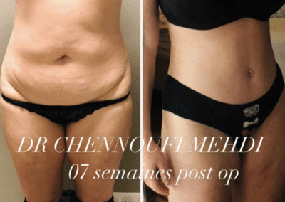 chirurgie esthetique Tunisie
