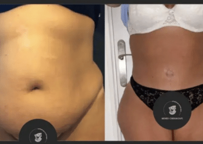 chirurgie esthétique Tunisie