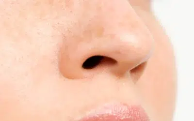 rhinoplastie La Rhinoplastie en Tunisie : Un Monde de Possibilités !