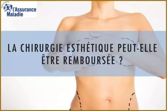 Quelle chirurgie est remboursé par la sécurité sociale ?