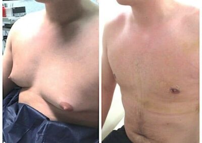 quelle est la meilleure chirurgie esthétique en Tunisie