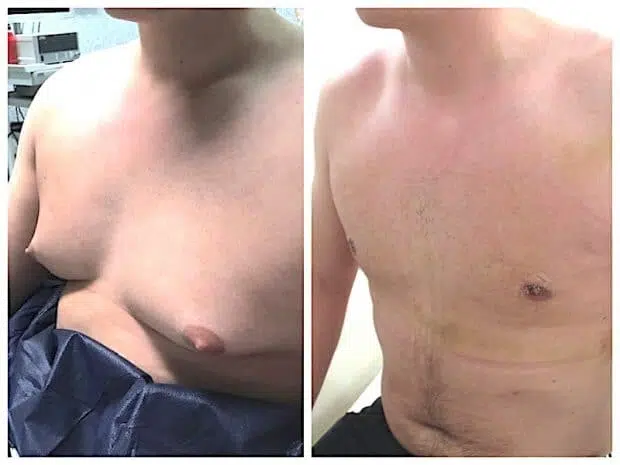 quelle est la meilleure chirurgie esthétique en Tunisie