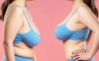 lifting mammaire avant apres sans protheses lifting des seins ptose mammaire En savoir plus a propos des techniques de lifting des seins