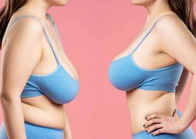 lifting seins tunisie au meilleur prix
