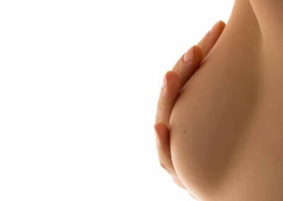 avoir une belle poitrine, incision mammaire