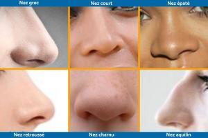 Types de nez chirurgie esthétique tunisie prix rhinoplastie, réduire taille de son nez