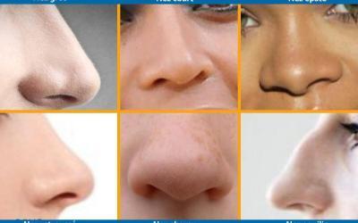 Types de nez