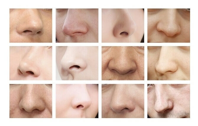 Différents types de nez, leurs imperfections spécifiques