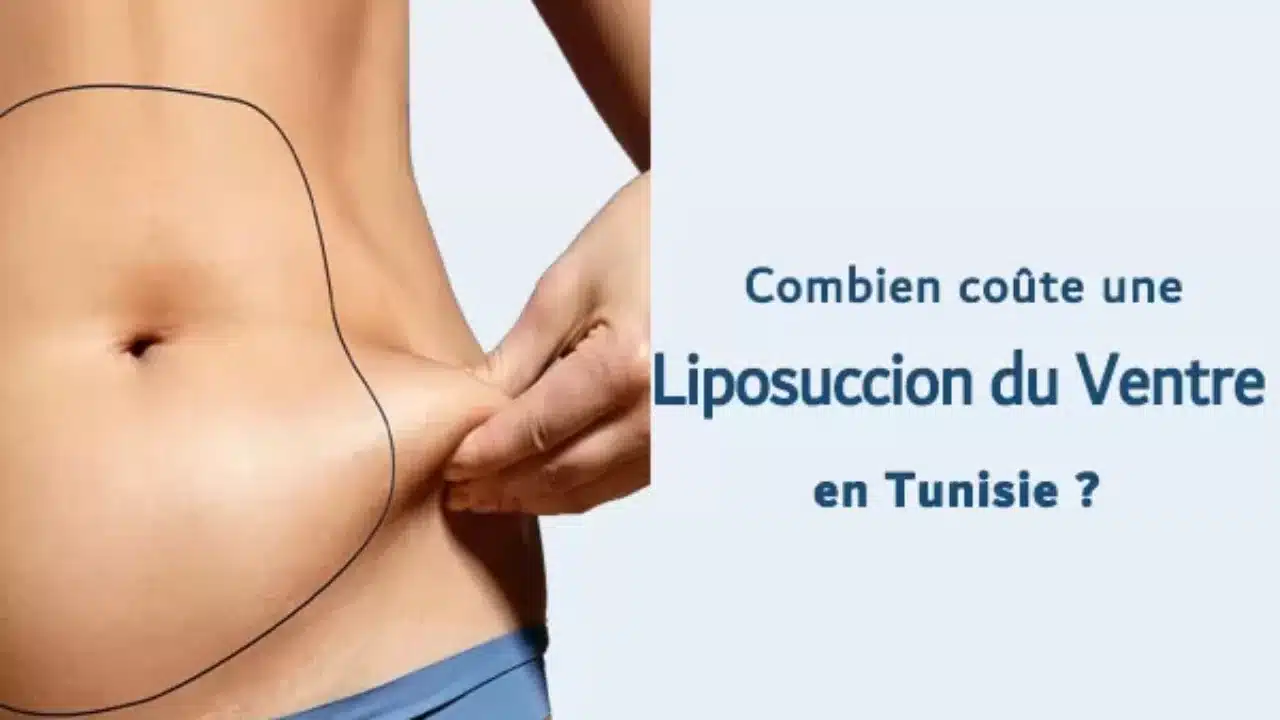 liposuccion Quel est le prix d'une liposuccion en Tunisie ?