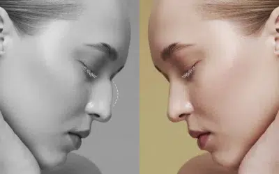 Quel est le prix pour une rhinoplastie ?