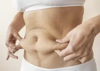 Liposuccion ventre Devis gratuit