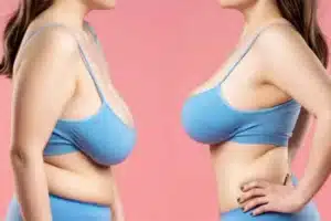 lifting mammaire tunisie grossesse