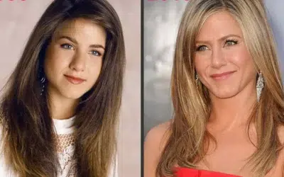 Jennifer aniston chirurgie Produits de comblement transfert de graisse rajeunir visage