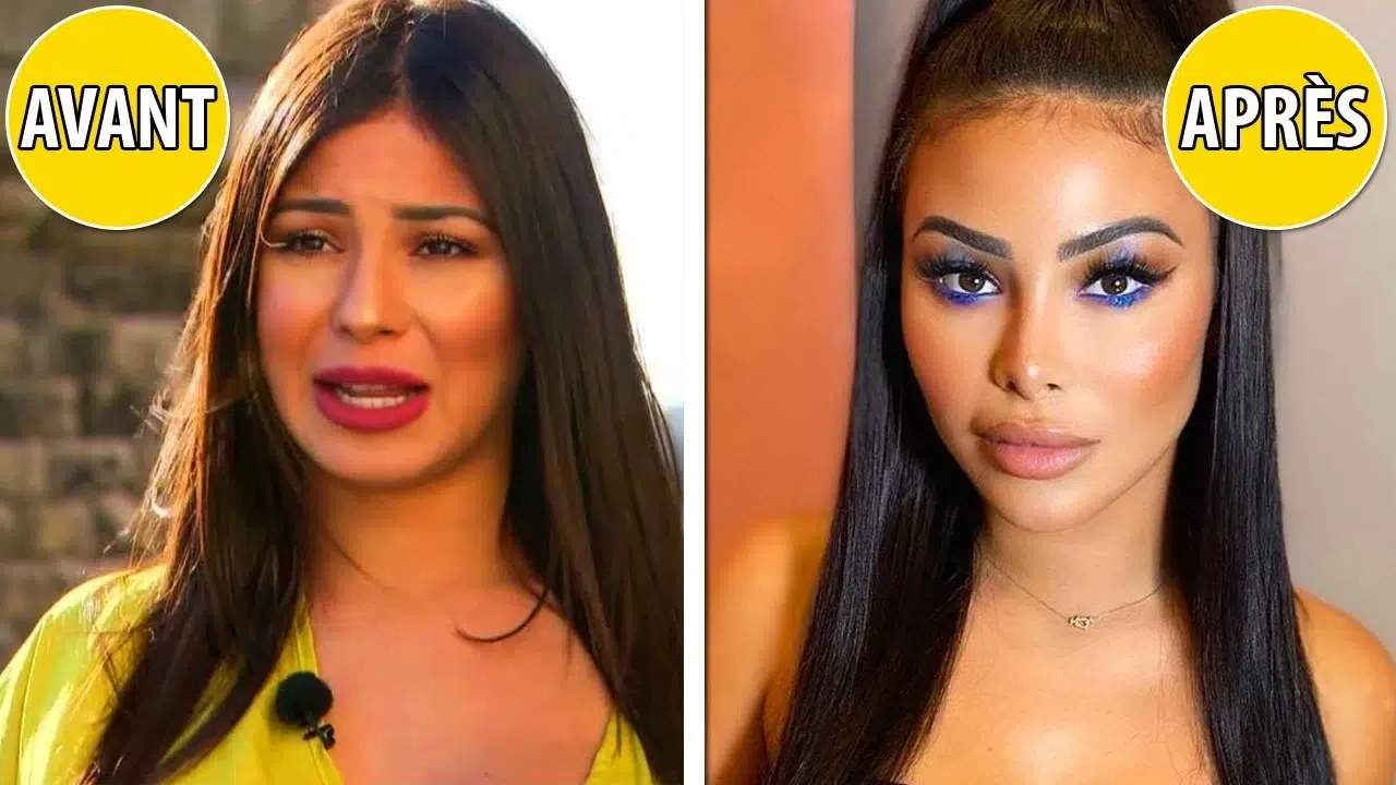 Maeva Ghennam Avant Chirurgie Esthétique 2023