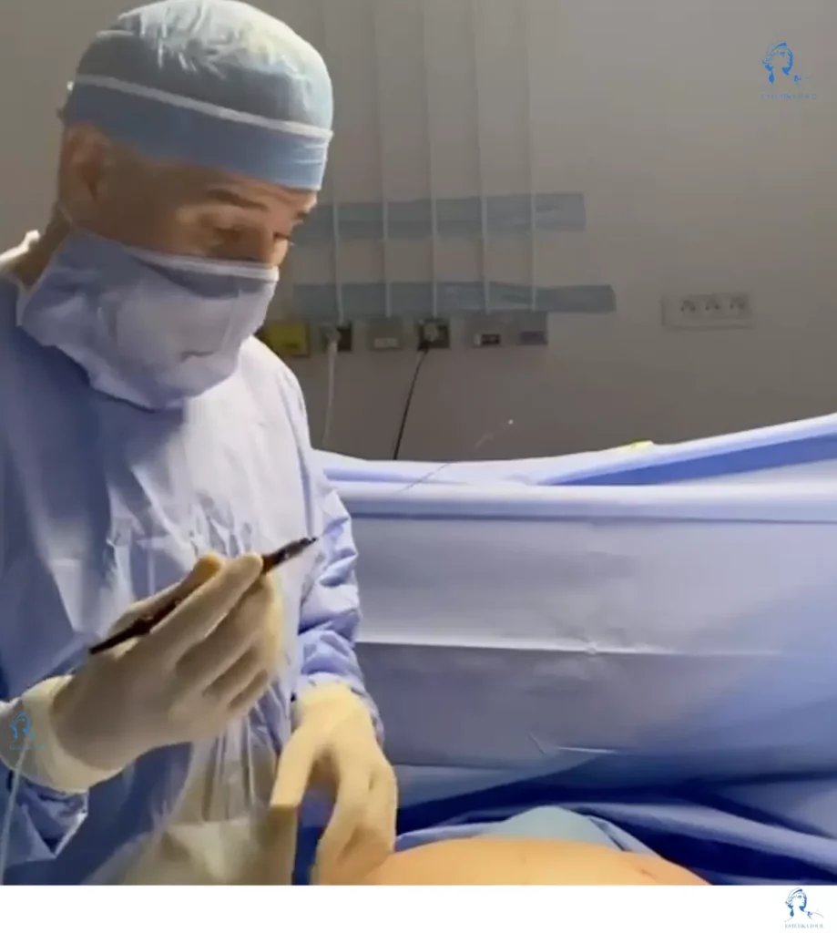 Chirurgie esthétique prix