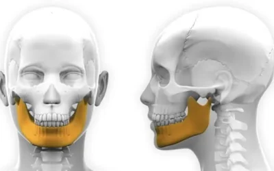 Chirurgie maxillo facial